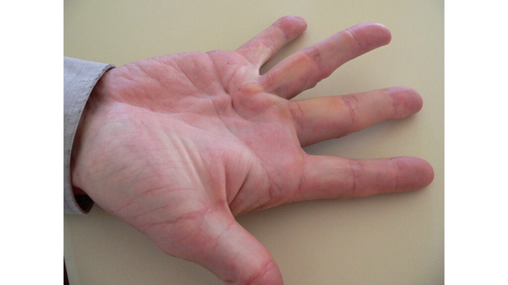 Come Viene Pagato L'Infortunio Sul Lavoro E Quali Sono I Diritti 4 Come Viene Pagato L’Infortunio Sul Lavoro E Quali Sono I Diritti