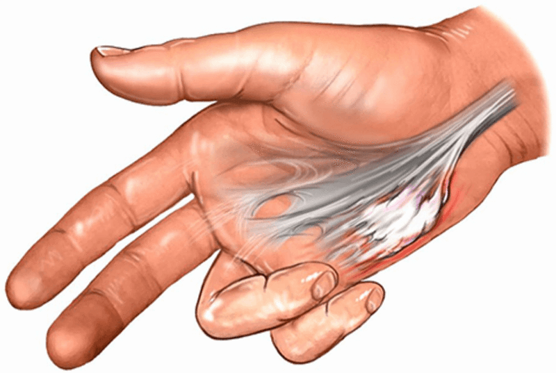 A chi rivolgersi per ricevere aiuto con la legge anti suicidi 8 A chi rivolgersi per ricevere aiuto con la legge anti suicidi