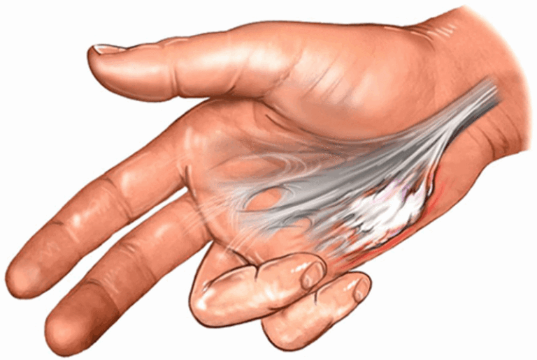 un accordo di pagamento con mani che si stringono