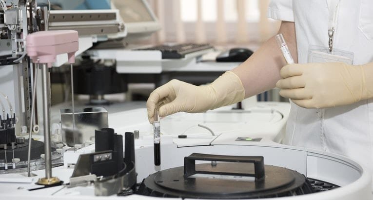 Quali sono i migliori kit per l'analisi dell'olio d'oliva 6 Quali sono i migliori kit per l’analisi dell’olio d’oliva